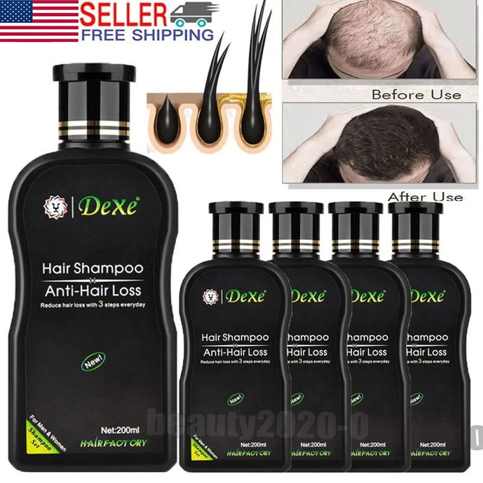 Hair Growth Shampoo Hair Regrowth Treatment Anti-Hair Loss Shampoo For Men&Women - Image 2 of 4