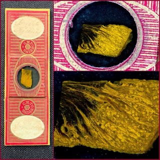 C.M.Topping Antique Microscope Slide. Bright's Kidney Injected & Corroded