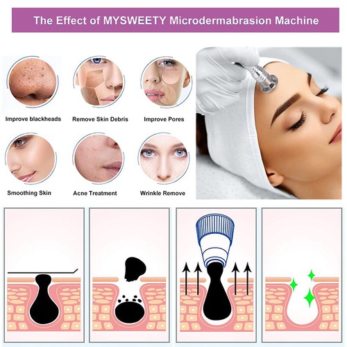Diamond Microdermabrasion Machine Diamond Peel Dermabrasion Facial Skin Care AUS - Picture 3 of 12