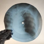LED ZEPPELIN WHOLA LOTTA LOVE X-Ray USSR Record Roentgen Bone Ribs Music Vinyl