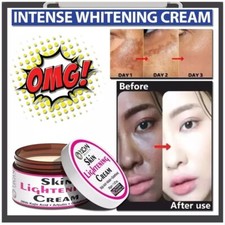 Skin Whitening Cream,Dark Spot Remover for Face,Skin Lightening Cream 50g
