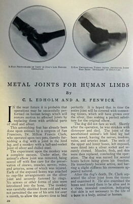 1913 Dr. Milton Francis Clark Joints for Human Limbs Artificial Joints