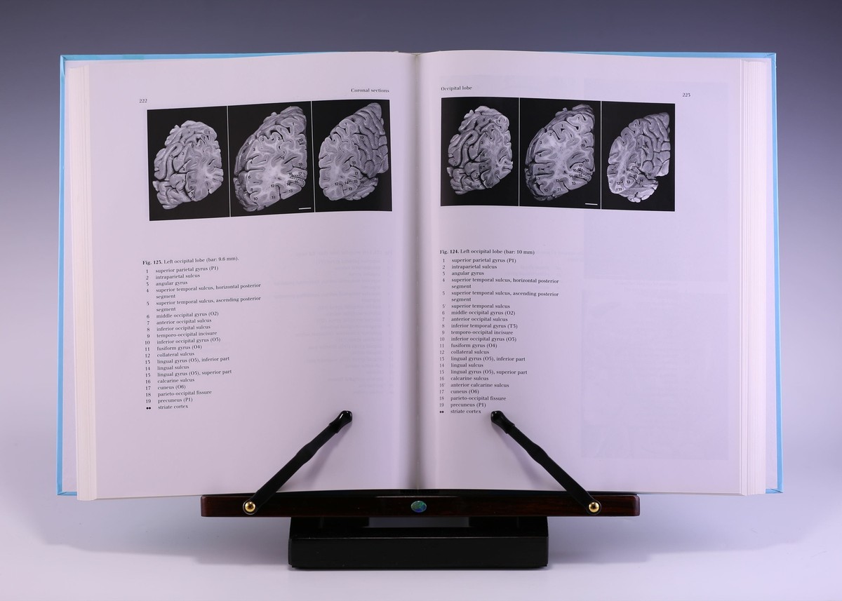 The Human Brain: Surface, Three-Dimensional 2nd Ed by Henri