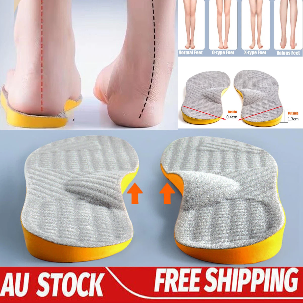 Arched insoles hot sale