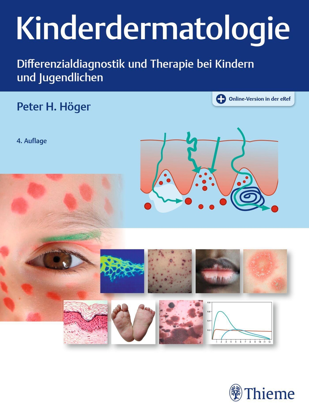 Thumbnail - Kinderdermatologie | Peter H. Höger | Bundle | Mixed Media Product | 1