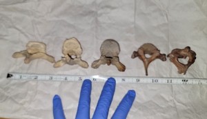 Human Vertebrae - Real Bone (Thoracic & Cervical)