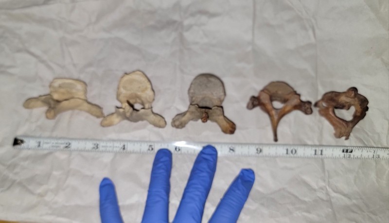 Human Vertebrae - Real Bone (Thoracic & Cervical)