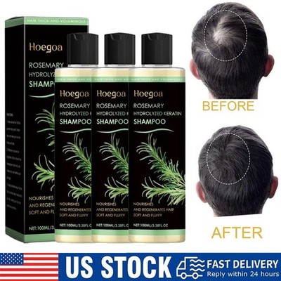 3 Pack Rosemary Hair Growth Shampoo Hydrolyzed Keratin Shampoo for Thinning Hair