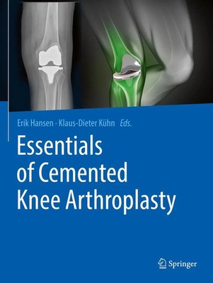Essentials of Cemented Knee Arthroplasty Erik Hansen (u. a.) Taschenbuch xxiii