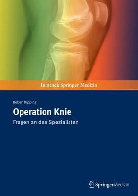 Operation Knie | Robert Kipping | Fragen an den Spezialisten | Taschenbuch | ix