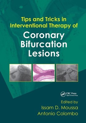 Tips and Tricks in Interventional Therapy of Coronary Bifurcation Lesions by Iss