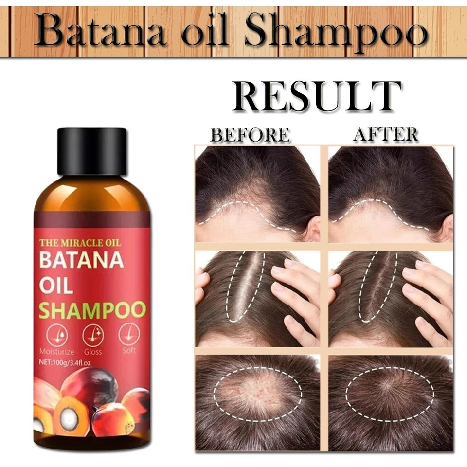 Batana Oil Shampoo for Hair Growth, 100% Batana Oil Shampoo Repairs Damaged Hair - Image 2 of 4