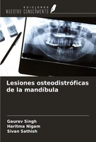 Gaurav Singh (U. A.) | Lesiones OsteodistróFicas De La MandíBula | Taschenbuch