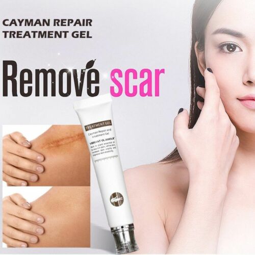 Repair Scar Cream Removal Scars for Face or Body Pigmentation Corrector  Scalded 829380192743 | eBay