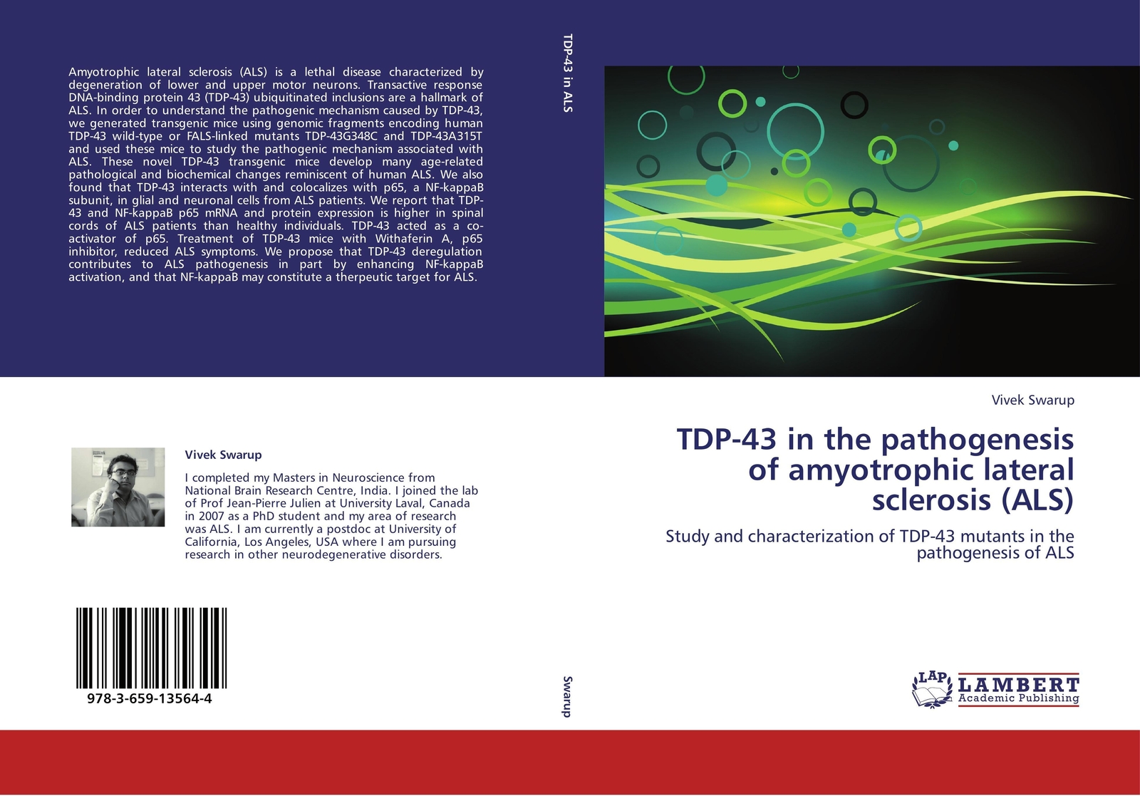 Thumbnail - Vivek Swarup | Tdp-43 In The Pathogenesis Of Amyotrophic Lateral