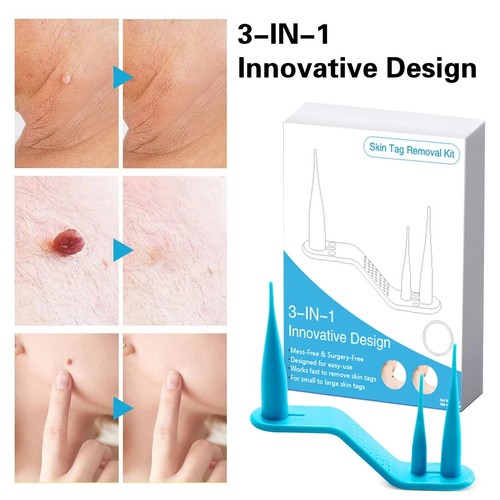 Kit de eliminación de etiquetas de piel natural 3 en 1 sin dolor para etiquetas de piel pequeñas/medianas (1 mm-8 mm) - Imagen 5 de 7