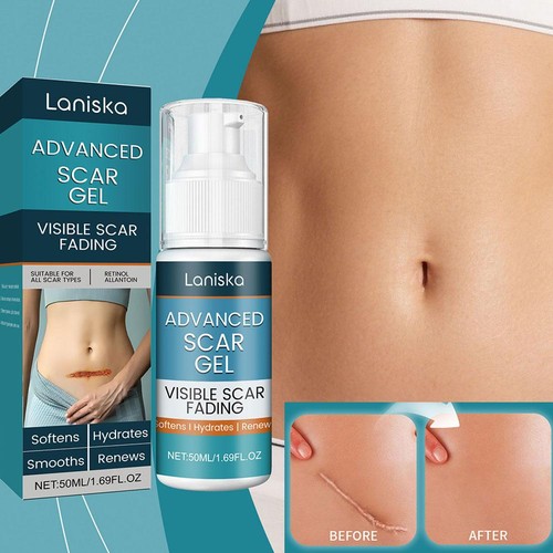50ml Scar Fading Acne Cream Silicone Removal Fade Old New Treatments Body - Picture 5 of 12