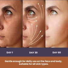 Kojic Acid Plus Natural Soap Bars with Retinol, Aloe vera, Turmeric 2 x 100 Gm