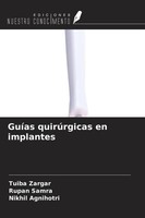 Tuiba Zargar (U. A.) | GuíAs QuirúRgicas En Implantes | Taschenbuch | Spanisch