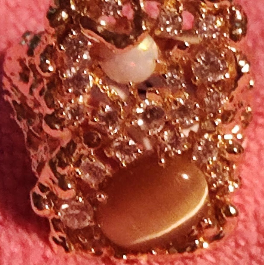 Picture 2 of 5