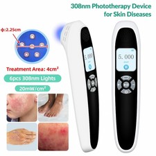 308nm UVB Blue Light Therapy Device 6 Diodes Ultraviolet Lamp for Skin Diseases