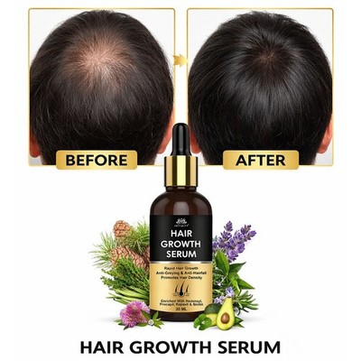 Hair Growth Oil Solution for Men Women Hair Regrowth, Reactivates Hair Follicles