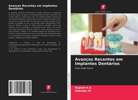 AvançOs Recentes Em Implantes DentáRios Rajesh K. S.