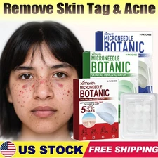 MICRONEEDLE BOTANIC Skin Tag & Acne Patch Skin Tag Remover Patches 9Pcs HOT 2025