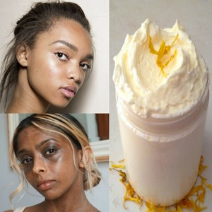 shea butter for hyperpigmentation