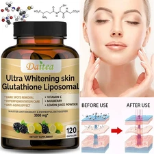 Glutathione Liposome Removes Dark Spots Detoxify Whiten Skin Antioxidant 120 Ct