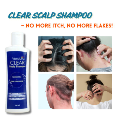 Psoriasis Kopfhaut Shampoo | Juckreizkontrolle & Flockenentfernung - Verdura Clear 200ml UK