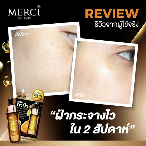 3x Merci Vitamin C Melasma Serum facial products skin nourishment Aura Radiant - Picture 5 of 15