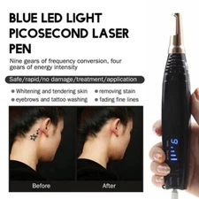 Laser Beauty Machine Tattoo Removal Pen Freckle Acne Mole Dark Spot Pigment Pen