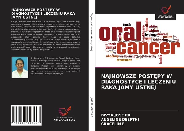 Najnowsze Post¿Py W Diagnostyce I Leczeniu Raka Jamy Ustnej Gracelin E-image
