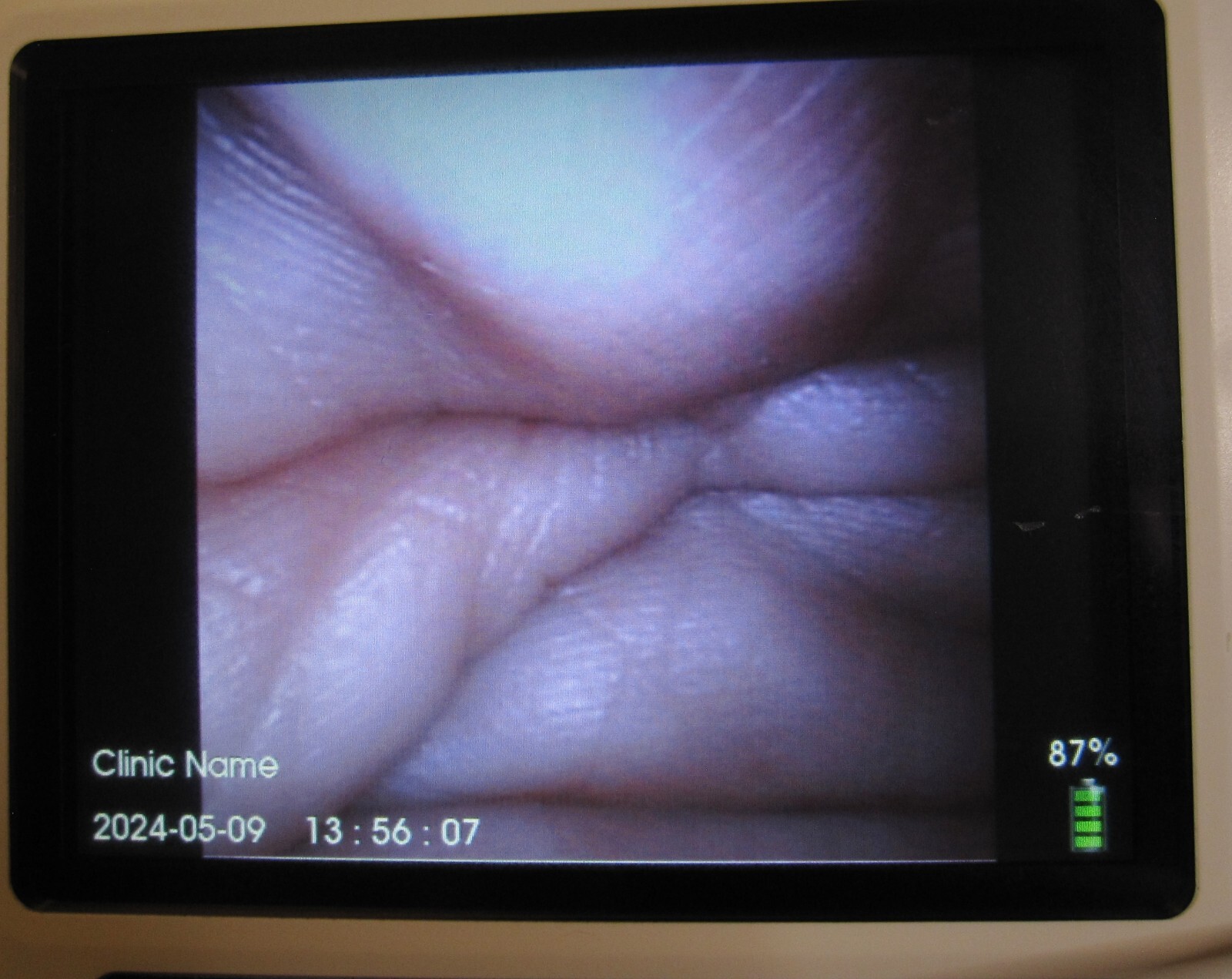 Picture 2 of 8