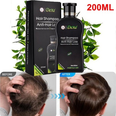 Fast Hair Growth Shampoo For Women Men Anti Hair Loss Treatment Care Thickening~