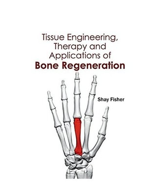 Tissue Engineering, Therapy and Applications of Bone Regeneration