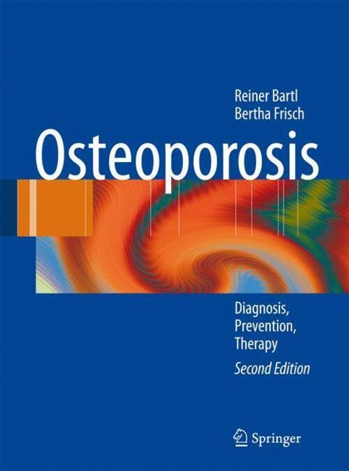 Thumbnail - Osteoporosis | Bertha Frisch (u. A.) | Diagnosis, Prevention, Therapy