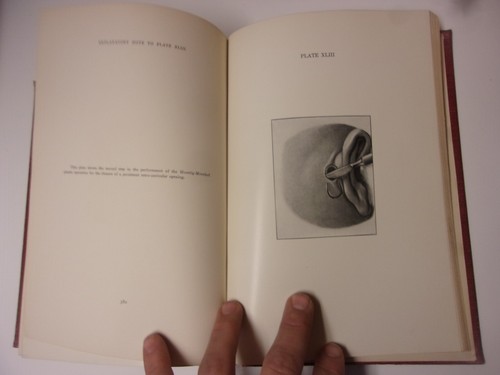 The Surgical Treatment of...the Middle Ear and Mastoid, Seymour Oppenheimer 1906 - Picture 15 of 16