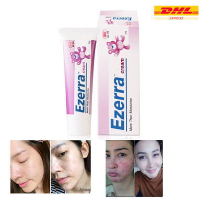 ezerra cream for eczema