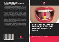 Kanhaiya Lal Gupta | De Dentes Tratados Endodonticamente: PorquÊ, Quando E Como