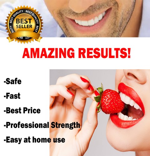 44 % ZAHNAUFHELLUNG 3D BLEICHGEL KIT LASER LED WEISS UV DENTAL LICHT - Bild 2 von 10