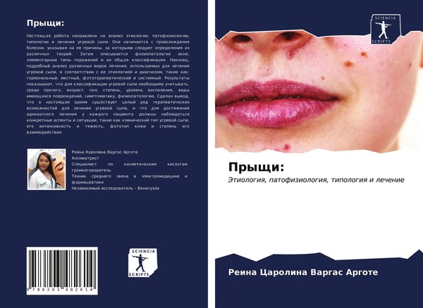 Pryschi: Jetiologiq, Patofiziologiq, Tipologiq I Lechenie Argote Taschenbuch-image
