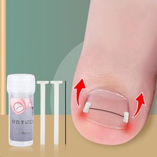 Ingrown Toenail Corrector Tools Pedicure Recover Embed Toe Nail Treatment