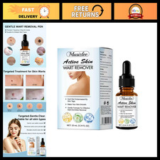Effective Skin Mole Remover for Hands  Body - Fast Acting, Safe  Easy Use