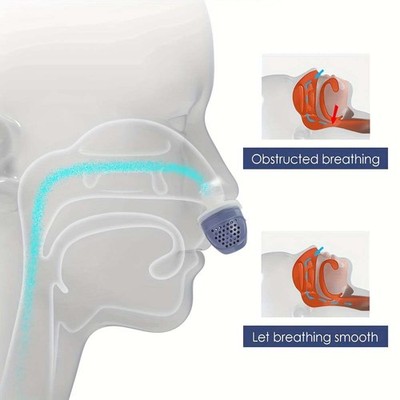Rechargeable Silent Effective Breathable Double Eddy Current Anti-snoring Device
