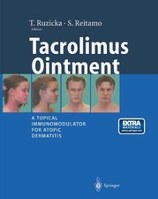 T. Ruzicka Tacrolimus Ointment (Paperback) (UK IMPORT)