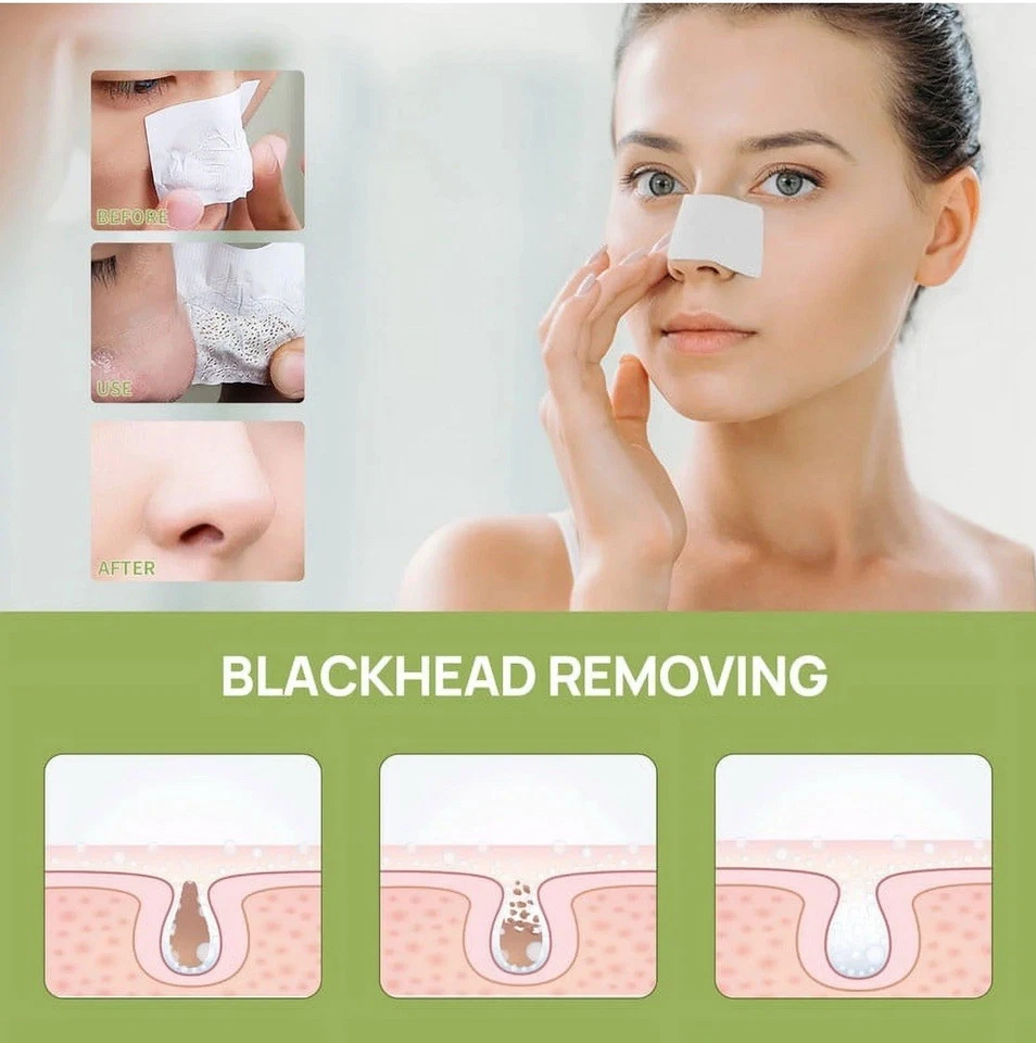 Máscara facial Lanbena Aloe Removedor de Espinillas Crema Nariz Poro Tiras, 30 g + 60 piezas Foto 3 de 4