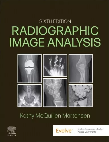 Radiographic Image Analysis - Picture 1 of 1