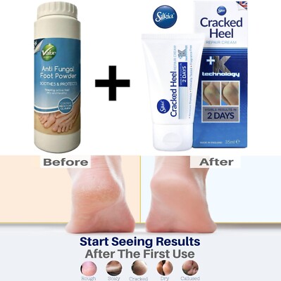 Athletes Foot Anti Fungal Foot Powder Cracked Heel Repair Cream